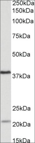 Anti-KLHDC8B antibody produced in goat