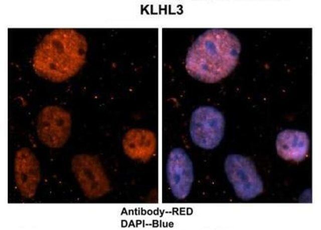 Anti-KLHL3, (N-terminal) antibody produced in rabbit