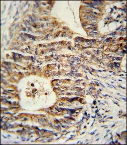 ANTI-KLHL24 (CENTER) antibody produced in rabbit