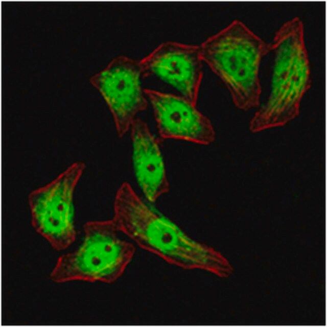 Anti-KLF4 Antibody, clone 1E6