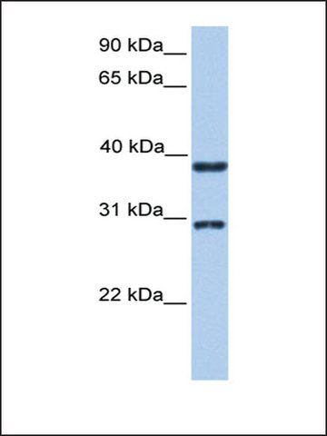 Anti-KLHDC1 antibody produced in rabbit