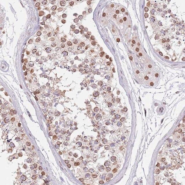 Anti-KLHDC2 antibody produced in rabbit