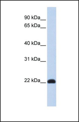 Anti-KLF16, (N-terminal) antibody produced in rabbit