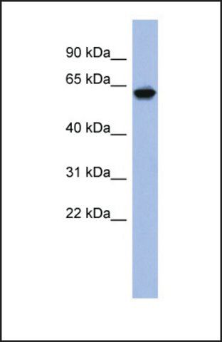 Anti-KLHL8, (N-terminal) antibody produced in rabbit