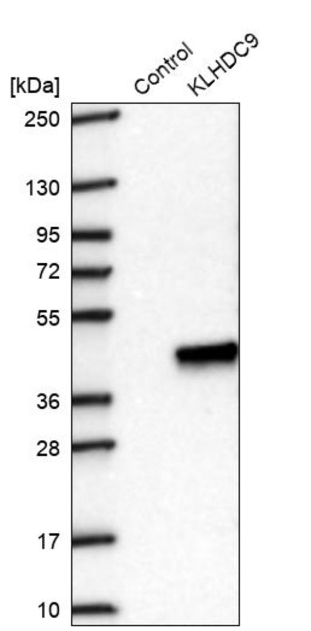 Anti-KLHDC9 antibody produced in rabbit