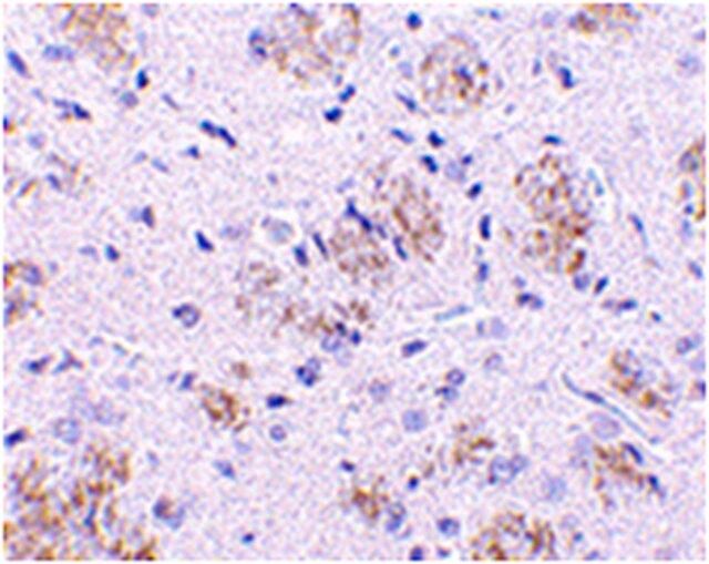 Anti-KLHL1 Antibody