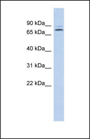 Anti-KLHL14, (N-terminal) antibody produced in rabbit