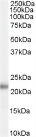 Anti-KLK2 antibody produced in goat