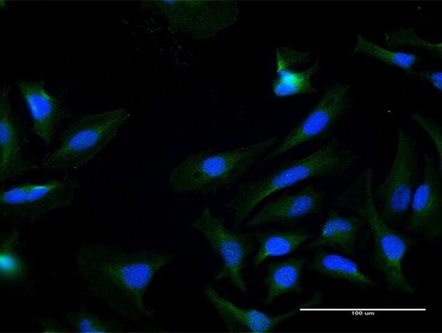 Anti-KLK7 antibody produced in mouse