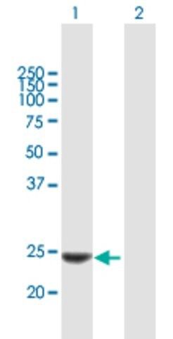 Anti-KLK14 antibody produced in mouse