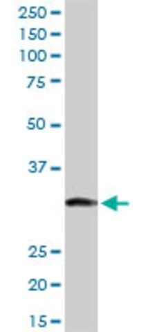 Anti-ITPK1 antibody produced in rabbit