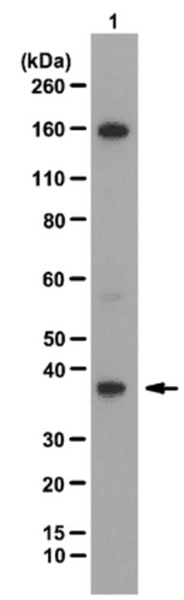 Anti-JMJD8 Antibody