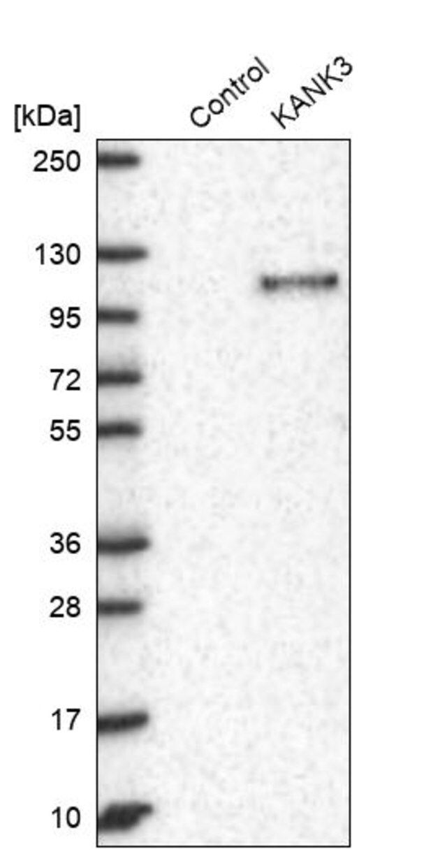 Anti-KANK3 antibody produced in rabbit