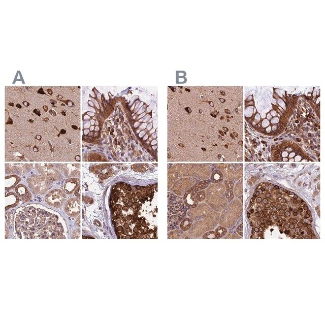 Anti-KARS antibody produced in rabbit