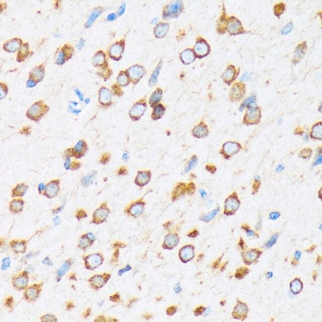 Anti-KAT9/Elp3 antibody produced in rabbit