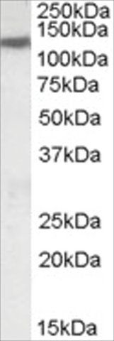 Anti-KCC3/SLC12A6 antibody produced in goat