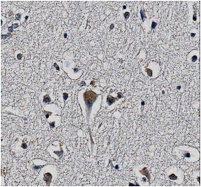 Anti-KChIP2 potassium channel subunit Antibody, clone 60/73