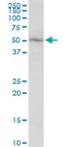 Anti-KATNA1 antibody produced in mouse