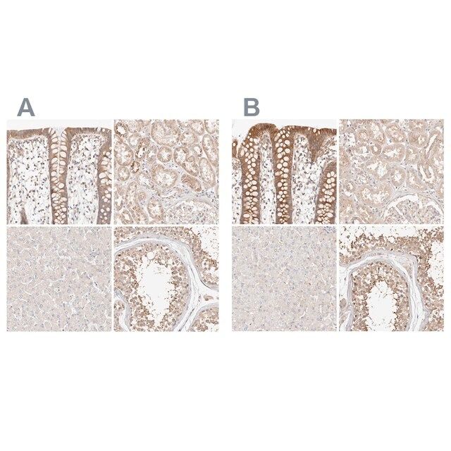 Anti-KCMF1 antibody produced in rabbit