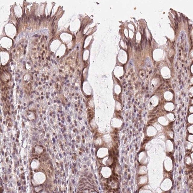 Anti-KAT6A antibody produced in rabbit