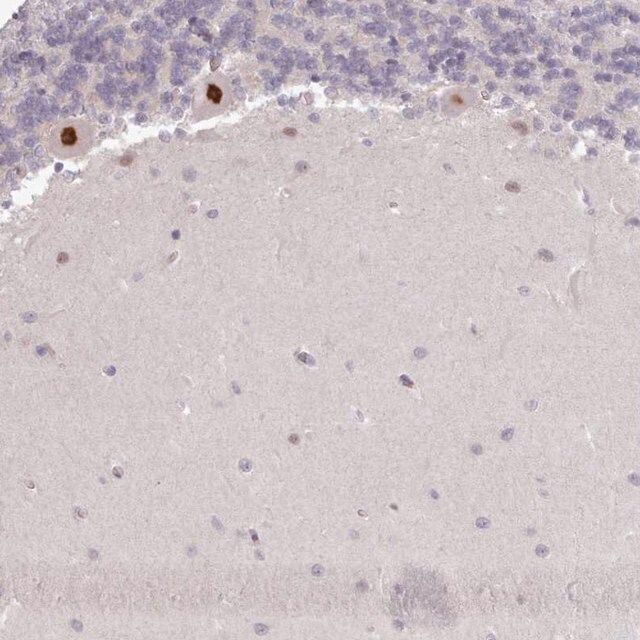 Anti-KBTBD6 antibody produced in rabbit