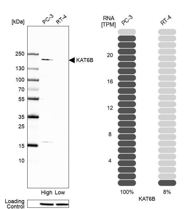 Anti-KAT6B antibody produced in rabbit