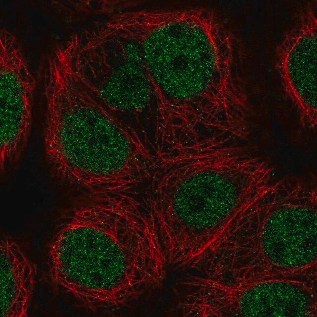 Anti-KAT8 antibody produced in rabbit