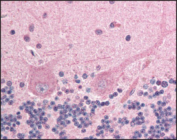 Anti-ING4 antibody produced in goat