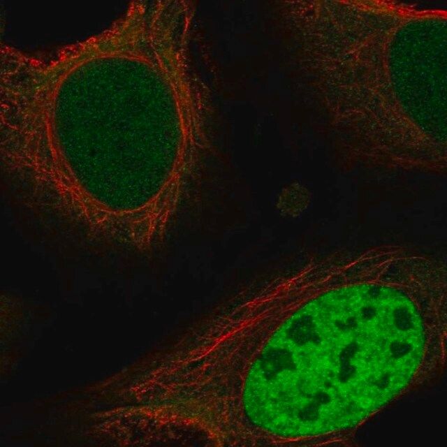 Anti-ING4 antibody produced in rabbit