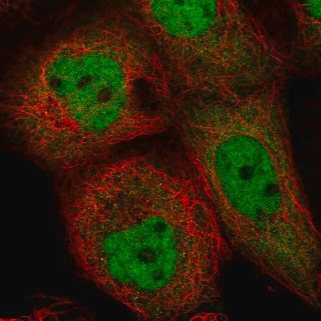 Anti-ING1 antibody produced in rabbit