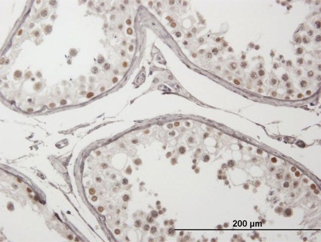 Anti-ING4 antibody produced in mouse