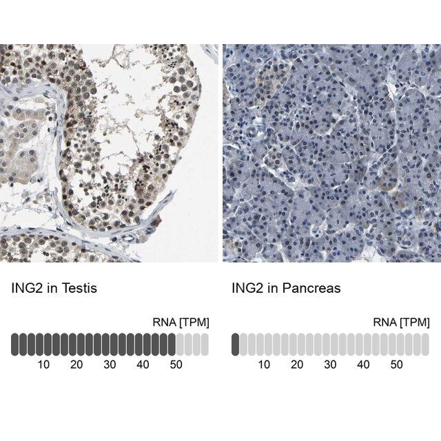 Anti-ING2 antibody produced in rabbit