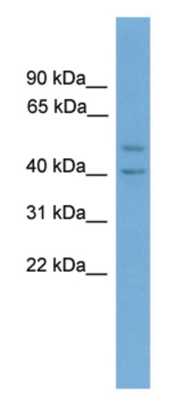 Anti-INHBA (N-terminal) antibody produced in rabbit