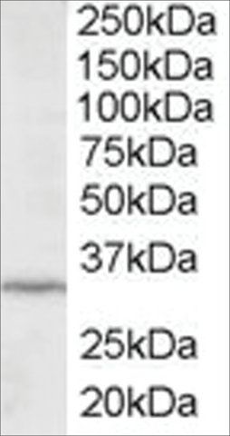 Anti-ING2/ING1L antibody produced in goat