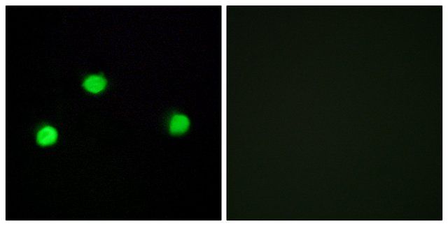 Anti-IP6K2 antibody produced in rabbit