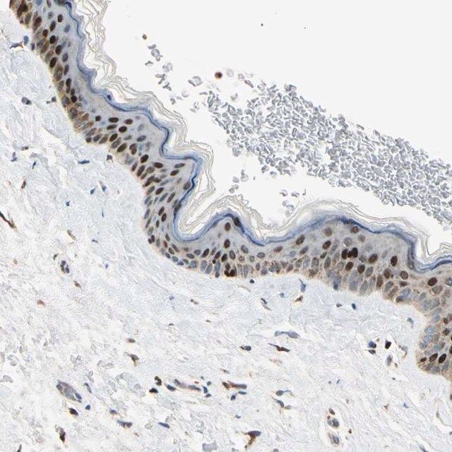 Anti-IP6K2 antibody produced in rabbit