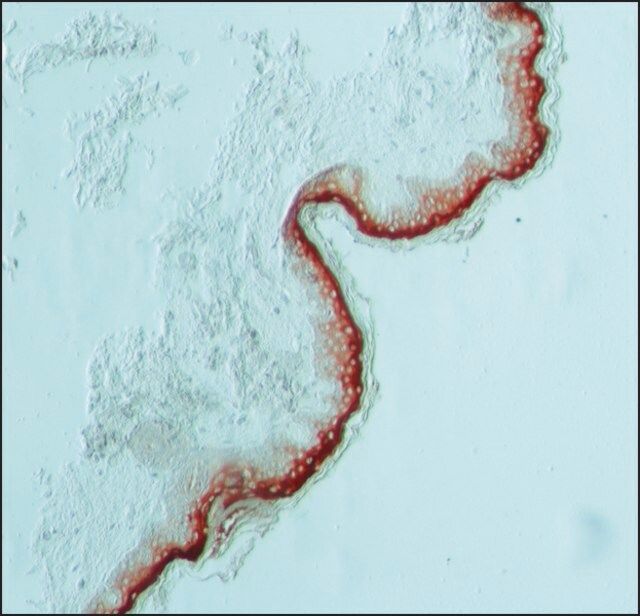 Anti-Involucrin antibody, Mouse monoclonal