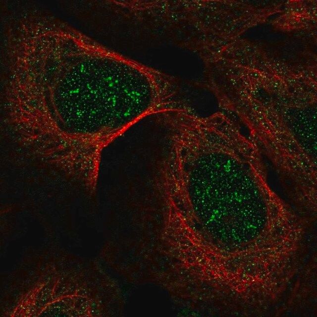 Anti-IP6K2 antibody produced in rabbit