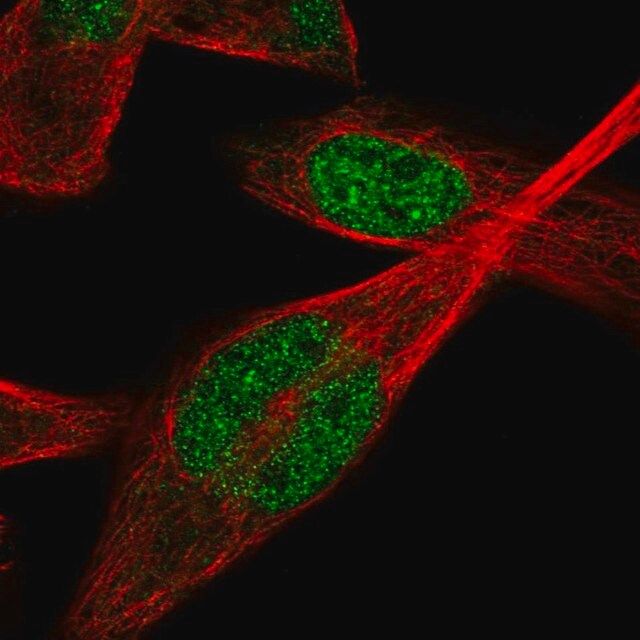 Anti-IPMK antibody produced in rabbit