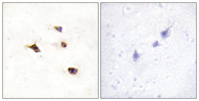 Anti-IP6K3 antibody produced in rabbit