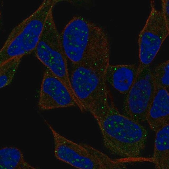 Anti-IPCEF1 antibody produced in rabbit