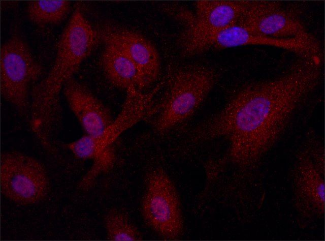 Anti-HSPB3 (11-25) antibody produced in rabbit