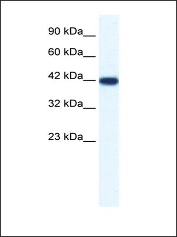 Anti-IBSP antibody produced in rabbit