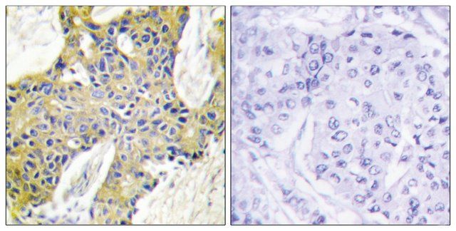 Anti-IARS2 antibody produced in rabbit