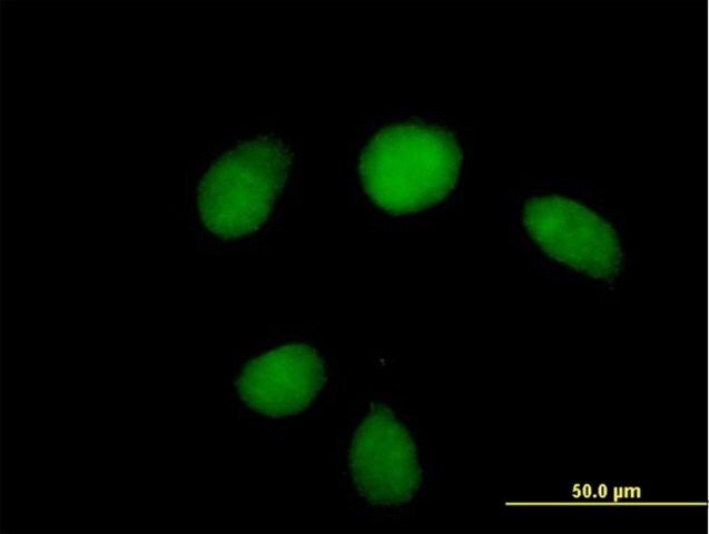 Anti-HUS1 antibody produced in mouse