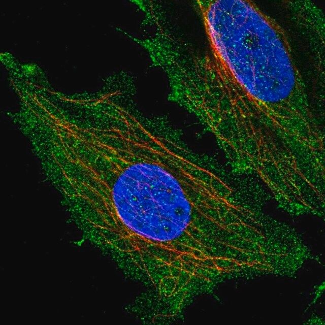 Anti-HYDIN antibody produced in rabbit