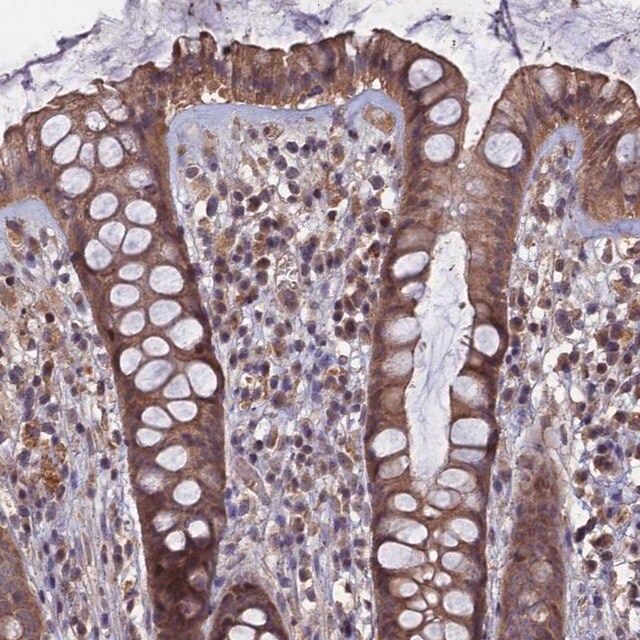 Anti-HUNK antibody produced in rabbit