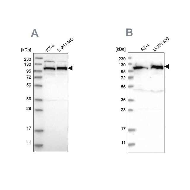 Anti-IARS2 antibody produced in rabbit