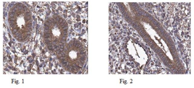 Anti-hyaluronan synthase 1 Antibody, clone 12A2.3