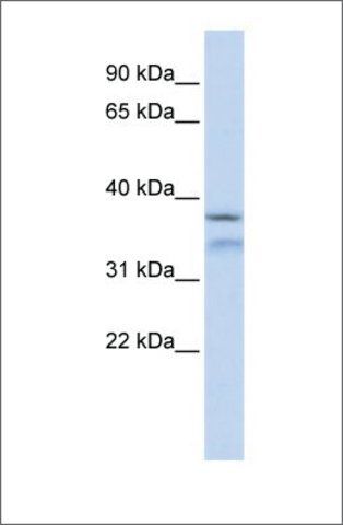 Anti-HYLS1 antibody produced in rabbit